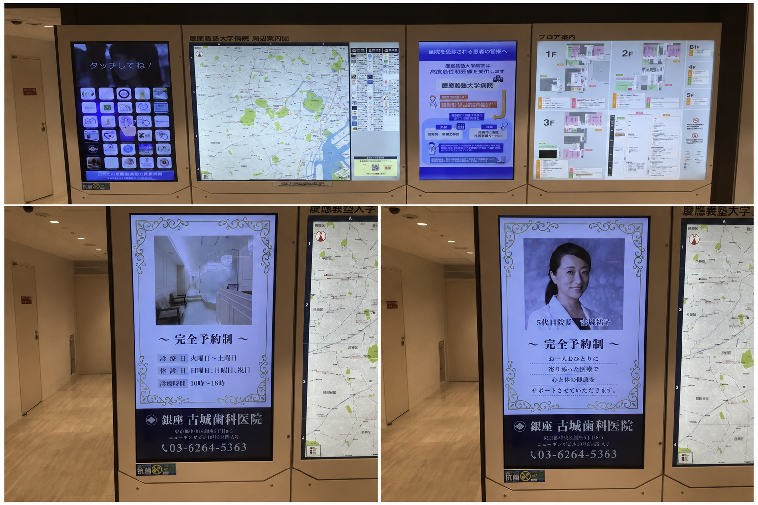 慶應義塾大学病院2階の医療連携大型パネルと銀座古城歯科医院の紹介画面